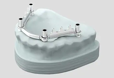 Normadent connessioni implantari 1 T Bar2