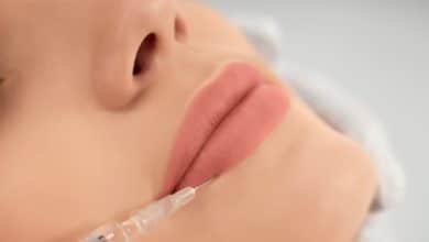 filler labbra milano